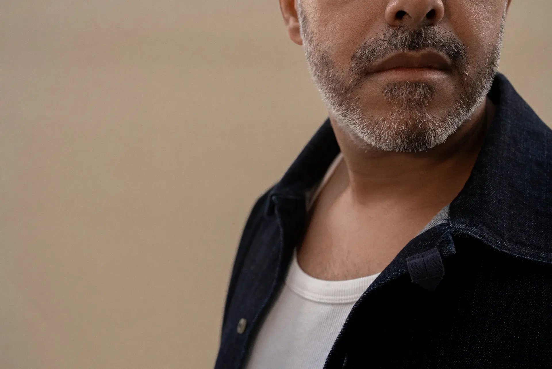 pourquoi choisir l'épilation laser homme