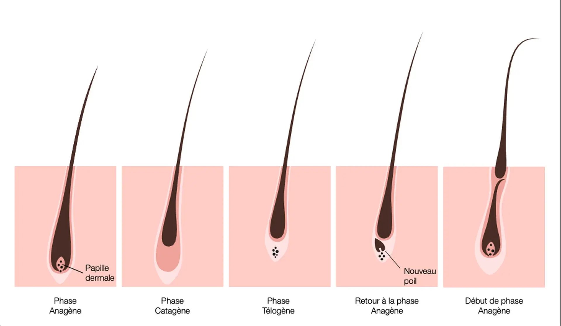 anagene-poil-epilation-laser-homme-paris