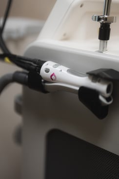 candela-yetylaser-epilation-alex-ndyag
