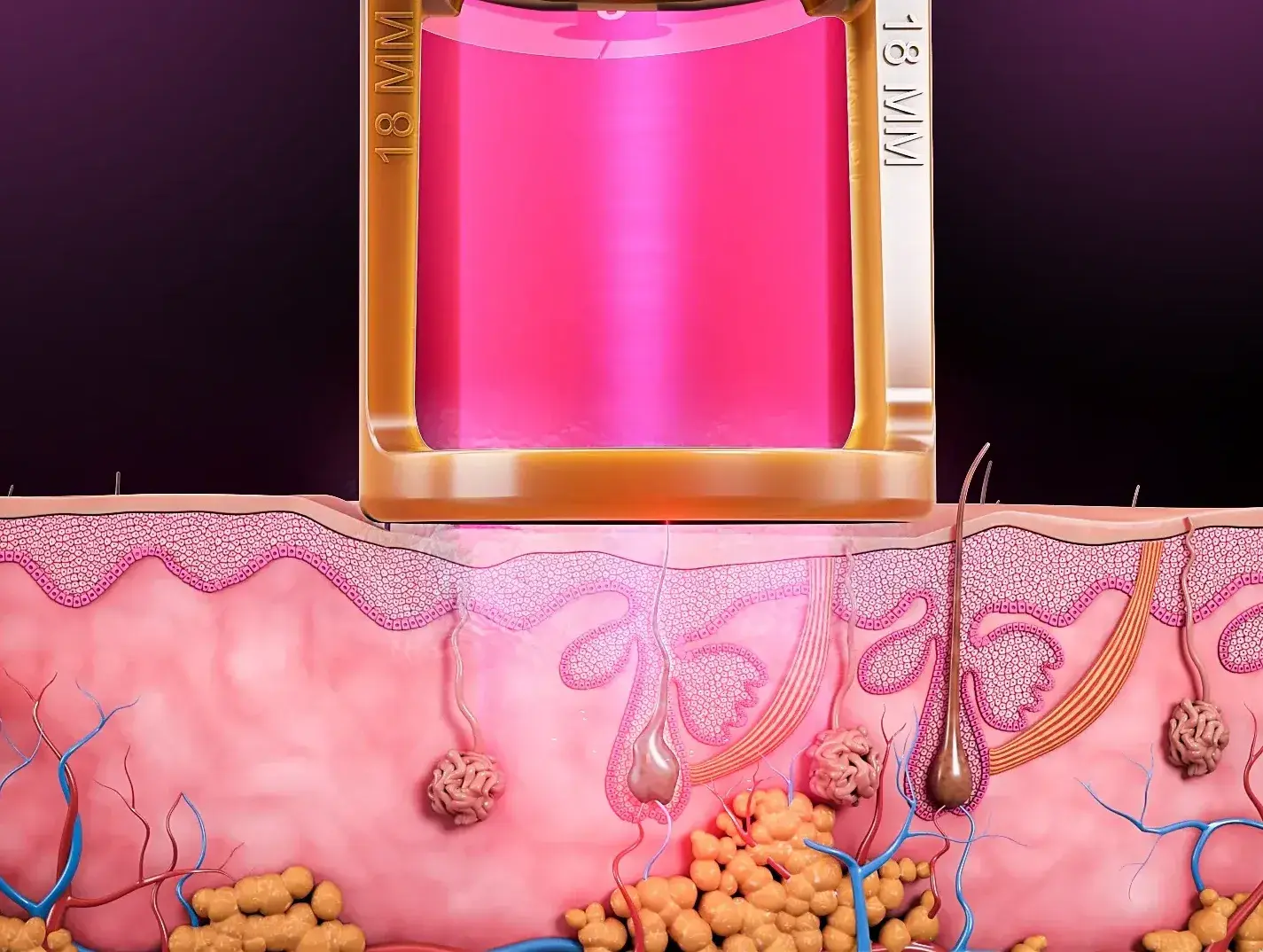 Repousse paradoxale et épilation laser : ce que les hommes doivent savoir
