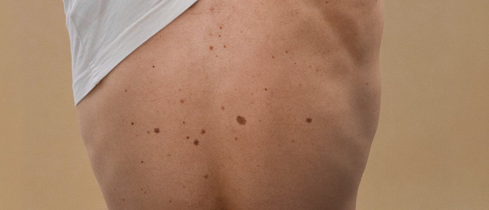 epilation-homme-avant-apres-paris-yety