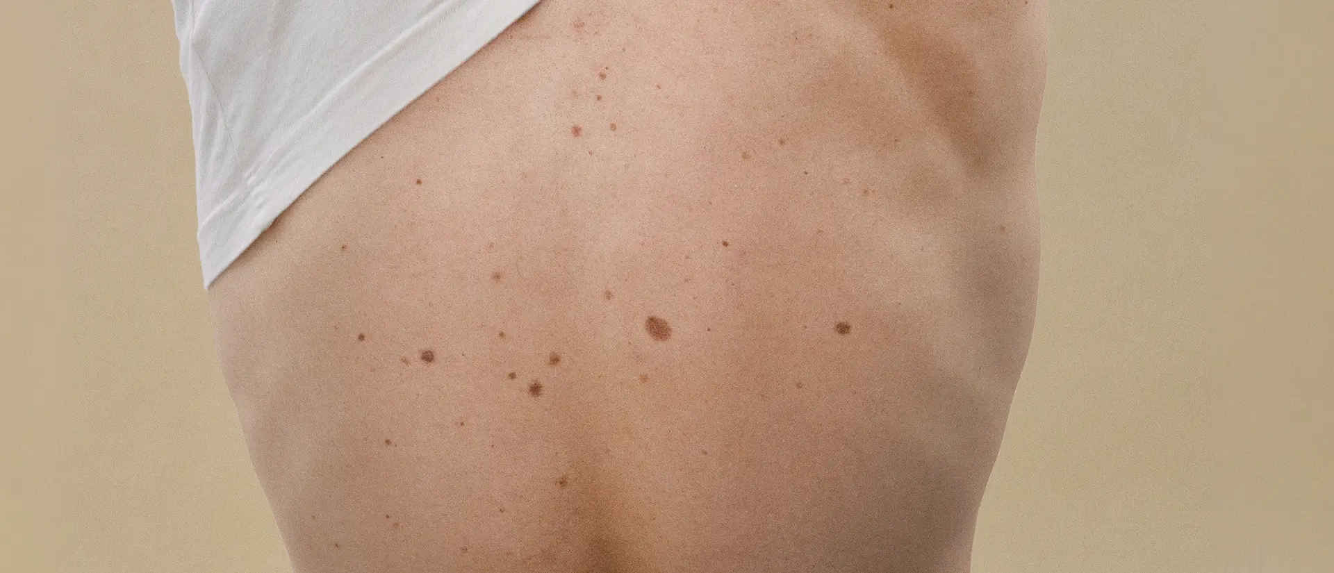 epilation-homme-avant-apres-paris-yety